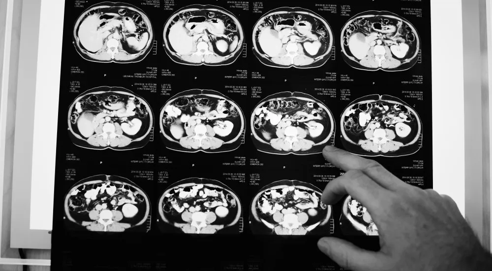Té verde para el cerebro: aumenta la memoria, fortalece y protege el cerebro Película de rayos X de tomografía computarizada cerebral Estoy Saludable Estoy Saludable - Contenidos e inteligencia artificial para tu salud Té verde para el cerebro: aumenta la memoria, fortalece y protege el cerebro
