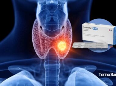 Câncer de Tireoide: planos de saúde devem incluir novo tratamento com Mesilato de Lenvatinibe (Lenvima). - Tenho Saúde Câncer de Tireoide planos de saúde devem incluir novo tratamento com Mesilato de Lenvatinibe (Lenvima). Tenho Saúde