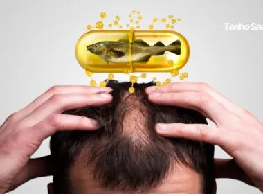 Estudo revela: Ômega 3 (óleo de peixe) pode causar queda de cabelo. - Tenho Saúde Estudo revela Ômega 3 (óleo de peixe) pode causar queda de cabelo e Calvisse. Tenho Saúde